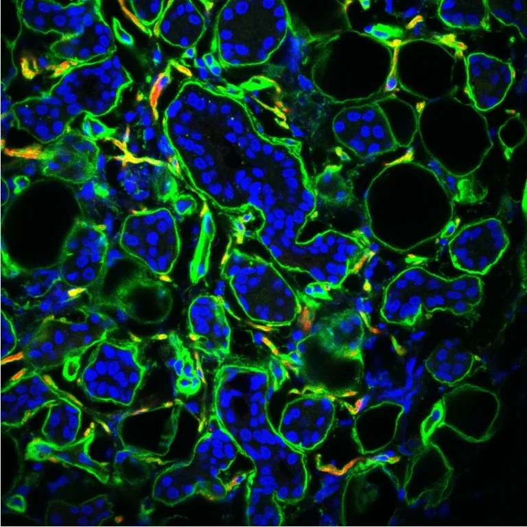 Confocal Portrait